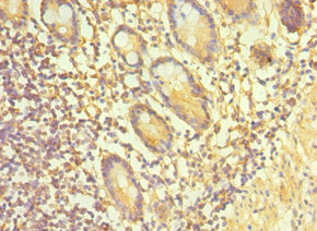 Immunohistochemistry of paraffin-embedded human small intestine tissue using TAC1 Antibody at dilution of 1:100Rabbit anti-Human TAC1 Polyclonal Antibody