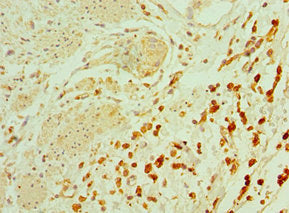 Immunohistochemistry of paraffin-embedded human epityphlon tissue using TAC1 Antibody at dilution of 1:100Rabbit anti-Human TAC1 Polyclonal Antibody