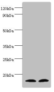 Western blot | All lanes: Protachykinin-1 antibody at 6μg/ml | Lane 1: Mouse liver tissue | Lane 2: 293T whole cell lysate | Secondary | Goat polyclonal to rabbit IgG at 1/10000 dilution | Predicted band size: 16, 14, 12 kDa | Observed band size: 16 kDaRabbit anti-Human TAC1 Polyclonal Antibody