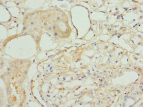 Immunohistochemistry of paraffin-embedded human kidney tissue using TAGLN2 Antibody at dilution of 1:100Rabbit anti-Human TAGLN2 Polyclonal Antibody