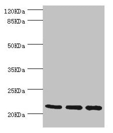 Western blot  | All lanes: TAGLN2 antibody at 2.64µg/ml  | Lane 1: 293T whole cell lysate  | Lane 2: K562 whole cell lysate  | Lane 3: MCF-7 whole cell lysate  | Secondary  | Goat polyclonal to rabbit IgG at 1/10000 dilution  | Predicted band size: 23, 25 kDa  | Observed band size: 23 kDaRabbit anti-Human TAGLN2 Polyclonal Antibody