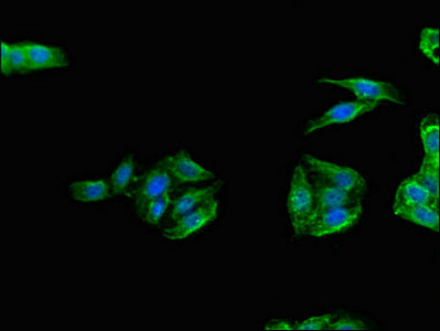 Immunofluorescent analysis of HepG2 cells using TANK Antibody at dilution of 1:100 and Alexa Fluor 488-congugated AffiniPure Goat Anti-Rabbit IgG(H+L)Rabbit anti-Human TANK Polyclonal Antibody