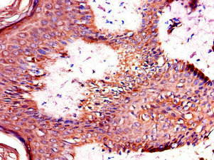 Immunohistochemistry of paraffin-embedded human skin tissue using the antibody at dilution of 1:100Rabbit anti-Human TANK Polyclonal Antibody