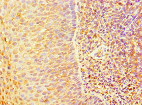 Immunohistochemistry of paraffin-embedded human tonsil tissue using TAP1 Antibody at dilution of 1:100Rabbit anti-Human TAP1 Polyclonal Antibody