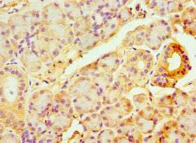 Immunohistochemistry of paraffin-embedded human pancreatic tissue using TAP1 Antibody at dilution of 1:100Rabbit anti-Human TAP1 Polyclonal Antibody