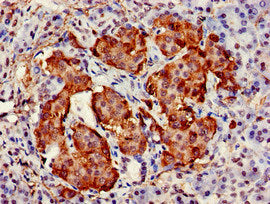 Immunohistochemistry of paraffin-embedded human pancreatic tissue using TARDBP Antibody at dilution of 1:100Rabbit anti-Human TARDBP Polyclonal Antibody