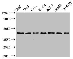 Western Blot  | Positive WB detected in: K562 whole cell lysate, A549 whole cell lysate, Hela whole cell lysate, HL60 whole cell lyasate, MCF-7 whole cell lysate, HepG2 whole cell lysate, SH-SY5Y whole cell lysate  | All lanes: TARDBP antibody at 2.5µg/ml  | Secondary  | Goat polyclonal to rabbit IgG at 1/50000 dilution  | Predicted band size: 45, 32 kDa  | Observed band size: 45 kDaRabbit anti-Human TARDBP Polyclonal Antibody