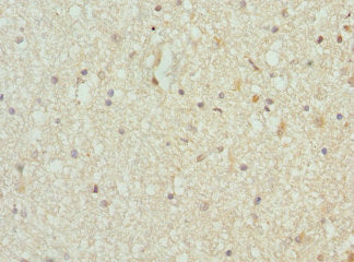 Immunohistochemistry of paraffin-embedded human brain tissue using TARS Antibody at dilution of 1:100Rabbit anti-Human TARS Polyclonal Antibody