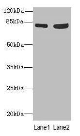 Western blot  | All lanes: TARS antibody at 4.85µg/ml  | Lane 1: A549 whole cell lysate  | Lane 2: Hela whole cell lysate  | Secondary  | Goat polyclonal to rabbit IgG at 1/10000 dilution  | Predicted band size: 84, 87 kDa  | Observed band size: 84 kDaRabbit anti-Human TARS Polyclonal Antibody