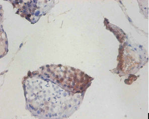 Immunohistochemistry of paraffin-embedded human testis tissue using COX6A1 Antibody at dilution of 1:100Rabbit anti-Human COX6A1 Polyclonal Antibody