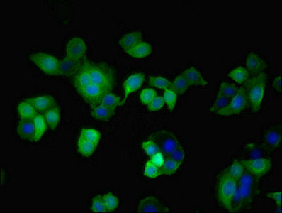 Immunofluorescent analysis of PC-3 cells using TAZ Antibody at dilution of 1:100 and Alexa Fluor 488-congugated AffiniPure Goat Anti-Rabbit IgG(H+L)Rabbit anti-Human TAZ Polyclonal Antibody