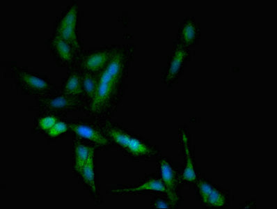 Immunofluorescent analysis of Hela cells using TBC1D4 Antibody at dilution of 1:100 and Alexa Fluor 488-congugated AffiniPure Goat Anti-Rabbit IgG(H+L)Rabbit anti-Human TBC1D4 Polyclonal Antibody