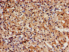 Immunohistochemistry analysis of human adrenal gland tissue using the antibody at dilution of 1:100Rabbit anti-Human TBC1D4 Polyclonal Antibody