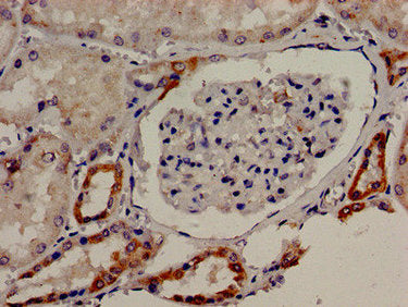 Immunocytochemistry analysis of human kidney tissue using TBC1D4 Antibody at dilution of 1:100Rabbit anti-Human TBC1D4 Polyclonal Antibody