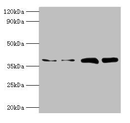 Western blot  | All lanes: TBCC antibody at 2µg/ml  | Lane 1: Hela whole cell lysate  | Lane 2: HepG2 whole cell lysate  | Lane 3: A549 whole cell lysate  | Lane 4: MCF-7 whole cell lysate  | Secondary  | Goat polyclonal to rabbit IgG at 1/10000 dilution  | Predicted band size: 40 kDa  | Observed band size: 40 kDaRabbit anti-Human TBCC Polyclonal Antibody