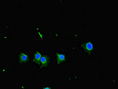 Immunofluorescent analysis of Hela cells using TBK1 Antibody at dilution of 1:100 and Alexa Fluor 488-congugated AffiniPure Goat Anti-Rabbit IgG(H+L)Rabbit anti-Human TBK1 Polyclonal Antibody
