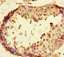 Immunohistochemistry of paraffin-embedded human testis tissue using TBK1 Antibody at dilution of 1:100Rabbit anti-Human TBK1 Polyclonal Antibody