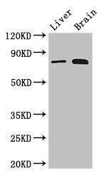 Western Blot | Positive WB detected in: Mouse liver tissue, Mouse brain tissue | All lanes: TBK1 antibody at 3μg/ml | Secondary | Goat polyclonal to rabbit IgG at 1/50000 dilution | Predicted band size: 84 kDa | Observed band size: 84 kDaRabbit anti-Human TBK1 Polyclonal Antibody