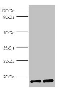Western blot  | All lanes: FKBP1A antibody at 2µg/ml  | Lane 1: EC109 whole cell lysate  | Lane 2: 293T whole cell lysate  | Secondary  | Goat polyclonal to rabbit IgG at 1/15000 dilution  | Predicted band size: 12 kDa  | Observed band size: 12 kDaRabbit anti-Human FKBP1A Polyclonal Antibody