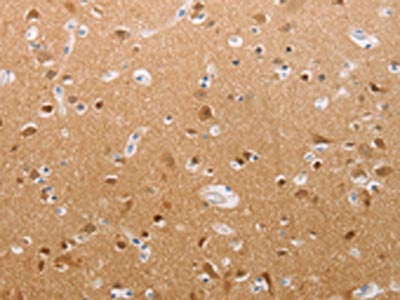 The image on the left is immunohistochemistry of paraffin-embedded Human brain tissue using the antibody Antibody) at dilution 1/30, on the right is treated with synthetic peptide. (Original magnification: ×200)Rabbit anti-Human PFN2 Polyclonal Antibody