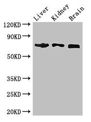 Western Blot | Positive WB detected in: Mouse liver tissue, Mouse kidney tissue, Mouse brain tissue | All lanes: TCF4 antibody at 2.7μg/ml | Secondary | Goat polyclonal to rabbit IgG at 1/50000 dilution | Predicted band size: 72, 55, 49, 66, 65, 58, 68, 64, 70, 69, 63 kDa | Observed band size: 72 kDaRabbit anti-Human TCF4 Polyclonal Antibody