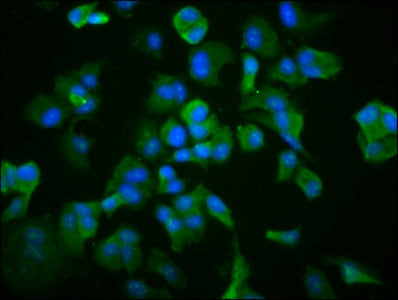 Immunofluorescence staining of MCF-7 cells with TCP1 Antibody at 1:266, counter-stained with DAPI. The cells were fixed in 4% formaldehyde, permeabilized using 0.2% Triton X-100 and blocked in 10% normal Goat Serum. The cells were then incubated with the antibody overnight at 4°C. The secondary antibody was Alexa Fluor 488-congugated AffiniPure Goat Anti-Rabbit IgG(H+L).Rabbit anti-Human TCP1 Polyclonal Antibody