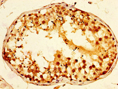 IHC image of TCP1 Antibody diluted at 1:800 and staining in paraffin-embedded human testis tissue performed on a Leica BondTM system. After dewaxing and hydration, antigen retrieval was mediated by high pressure in a citrate buffer (pH 6.0). Section was blocked with 10% normal goat serum 30min at RT. Then primary antibody (1% BSA) was incubated at 4°C overnight. The primary is detected by a biotinylated secondary antibody and visualized using an HRP conjugated SP system.Rabbit anti-Human TCP1 Polyclonal Antibody