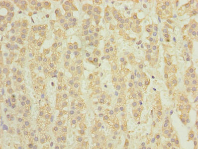 Immunohistochemistry of paraffin-embedded human adrenal gland tissue using TCTA Antibody at dilution of 1:100Rabbit anti-Human TCTA Polyclonal Antibody