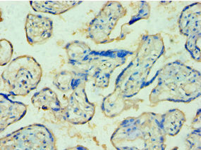 Immunohistochemistry of paraffin-embedded human placenta tissue using TDP1 Antibody at dilution of 1:100Rabbit anti-Human TDP1 Polyclonal Antibody