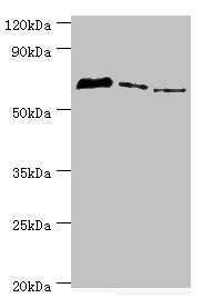 Western blot | All lanes: Tyrosyl-DNA phosphodiesterase 1 antibody at 8μg/ml | Lane 1: MCF-7 whole cell lysate | Lane 2: Mouse lung tissue | Lane 3: Rat brain tissue | Secondary | Goat polyclonal to rabbit IgG at 1/10000 dilution | Predicted band size: 69, 42 kDa | Observed band size: 69 kDaRabbit anti-Human TDP1 Polyclonal Antibody