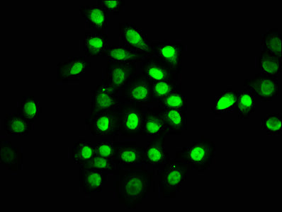 Immunofluorescence staining of A549 cells with TEAD1 Antibody at 1:147, counter-stained with DAPI. The cells were fixed in 4% formaldehyde, permeabilized using 0.2% Triton X-100 and blocked in 10% normal Goat Serum. The cells were then incubated with the antibody overnight at 4°C. The secondary antibody was Alexa Fluor 488-congugated AffiniPure Goat Anti-Rabbit IgG(H+L).Rabbit anti-Human TEAD1 Polyclonal Antibody