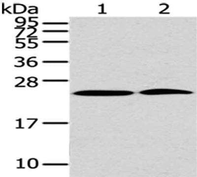 Gel: 12%SDS-PAGE,Lysate: 40 μg,Lane 1-2: 293T cells, Hela cells,Primary antibody: PDPN Antibody(PDPN Antibody) at dilution 1/200 dilution,Secondary antibody: Goat anti rabbit IgG at 1/8000 dilution,Exposure time: 2 minutesRabbit anti-Human PDPN Polyclonal Antibody
