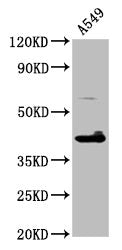 Western Blot  | Positive WB detected in: A549 whole cell lysate  | All lanes: TFB1M antibody at 4.6µg/ml  | Secondary  | Goat polyclonal to rabbit IgG at 1/50000 dilution  | Predicted band size: 40 kDa  | Observed band size: 40 kDa