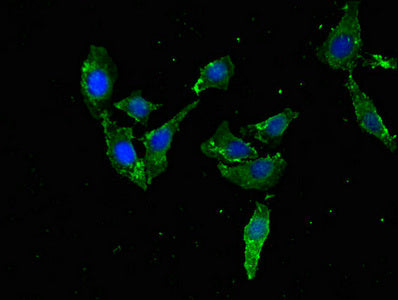Immunofluorescent analysis of Hela cells using TFEB Antibody at dilution of 1:100 and Alexa Fluor 488-congugated AffiniPure Goat Anti-Rabbit IgG(H+L)Rabbit anti-Human TFEB Polyclonal Antibody