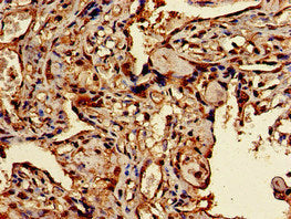 Immunohistochemistry of paraffin-embedded human placenta tissue using the antibody at dilution of 1:100Rabbit anti-Human TFEB Polyclonal Antibody