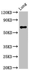 Western Blot | Positive WB detected in: Rat lung tissue | All lanes: TFEB antibody at 3μg/ml | Secondary | Goat polyclonal to rabbit IgG at 1/50000 dilution | Predicted band size: 53, 44 kDa | Observed band size: 70 kDaRabbit anti-Human TFEB Polyclonal Antibody