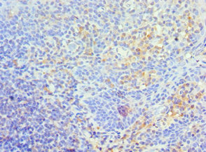 Immunohistochemistry of paraffin-embedded human tonsil tissue using TFPI2 Antibody at dilution of 1:100Rabbit anti-Human TFPI2 Polyclonal Antibody