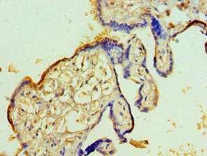 Immunohistochemistry of paraffin-embedded human placenta tissue using TFPI2 Antibody at dilution of 1:100Rabbit anti-Human TFPI2 Polyclonal Antibody