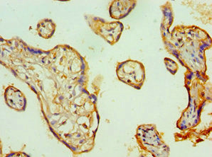 Immunohistochemistry of paraffin-embedded human placenta tissue using TFPI2 Antibody at dilution of 1:100Rabbit anti-Human TFPI2 Polyclonal Antibody
