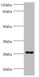 Western blot | All lanes: factor pathway inhibitor 2 antibody at 4μg/ml + Mouse liver tissue | Secondary | Goat polyclonal to rabbit IgG at 1/10000 dilution | Predicted band size: 27, 26 kDa | Observed band size: 27 kDaRabbit anti-Human TFPI2 Polyclonal Antibody