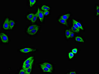 Immunofluorescence staining of HepG2 cells with TGFBR1 Antibody at 1:400, counter-stained with DAPI. The cells were fixed in 4% formaldehyde, permeabilized using 0.2% Triton X-100 and blocked in 10% normal Goat Serum. The cells were then incubated with the antibody overnight at 4°C. The secondary antibody was Alexa Fluor 488-congugated AffiniPure Goat Anti-Rabbit IgG(H+L).Rabbit anti-Human TGFBR1 Polyclonal Antibody
