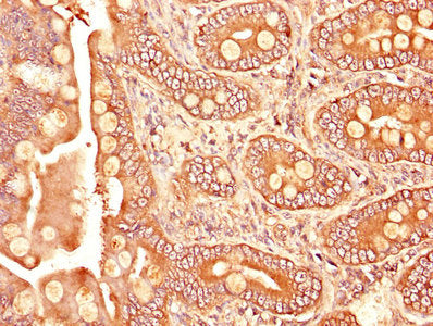 IHC image of TGFBR1 Antibody diluted at 1:1200 and staining in paraffin-embedded human small intestine tissue performed on a Leica BondTM system. After dewaxing and hydration, antigen retrieval was mediated by high pressure in a citrate buffer (pH 6.0). Section was blocked with 10% normal goat serum 30min at RT. Then primary antibody (1% BSA) was incubated at 4°C overnight. The primary is detected by a biotinylated secondary antibody and visualized using an HRP conjugated SP system.Rabbit anti-Human TGFBR1 Polyclonal Antibody