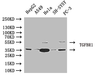 Western Blot  | Positive WB detected in: Jurkat whole cell lysate, SH-SY5Y whole cell lysate  | All lanes: TGFBR1 antibody at 4µg/ml  | Secondary  | Goat polyclonal to rabbit IgG at 1/50000 dilution  | Predicted band size: 56, 57, 48 kDa  | Observed band size: 56 kDaRabbit anti-Human TGFBR1 Polyclonal Antibody