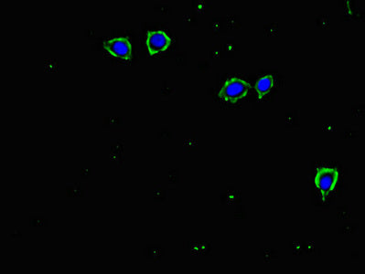 Immunofluorescent analysis of MCF-7 cells using TGFBR2 Antibody at dilution of 1:100 and Alexa Fluor 488-congugated AffiniPure Goat Anti-Rabbit IgG(H+L)Rabbit anti-Human TGFBR2 Polyclonal Antibody