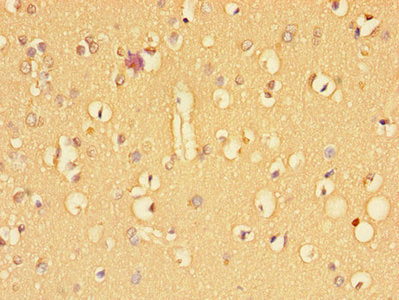 Immunohistochemistry of paraffin-embedded human brain tissue using the antibody at dilution of 1:100Rabbit anti-Human TGFBR2 Polyclonal Antibody