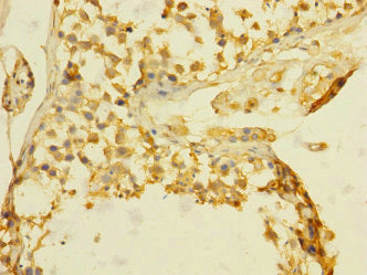 Immunohistochemistry of paraffin-embedded human testis tissue using TGFBR3 Antibody at dilution of 1:100Rabbit anti-Human TGFBR3 Polyclonal Antibody
