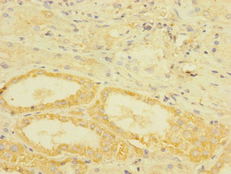Immunohistochemistry of paraffin-embedded human kidney tissue using TGFBR3 Antibody at dilution of 1:100Rabbit anti-Human TGFBR3 Polyclonal Antibody