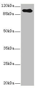 Western blot | All lanes: TGFBR3 antibody IgG at 2.39μg/ml + Hela whole cell lysate | Secondary | Goat polyclonal to rabbit IgG at 1/10000 dilution | Predicted band size: 93 kDa | Observed band size: 93 kDaRabbit anti-Human TGFBR3 Polyclonal Antibody