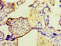 Immunohistochemistry of paraffin-embedded human placenta tissue using TGM2 Antibody at dilution of 1:100Rabbit anti-Human TGM2 Polyclonal Antibody
