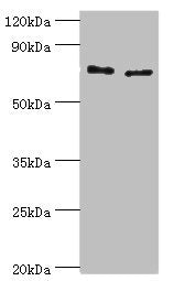 Western blot | All lanes: Protein-glutamine gamma-glutamyltransferase 2 antibody at 8μg/ml | Lane 1: Hela whole cell lysate | Lane 2: HepG2 whole cell lysate | Secondary | Goat polyclonal to rabbit IgG at 1/10000 dilution | Predicted band size: 78, 62, 39 kDa | Observed band size: 78 kDaRabbit anti-Human TGM2 Polyclonal Antibody